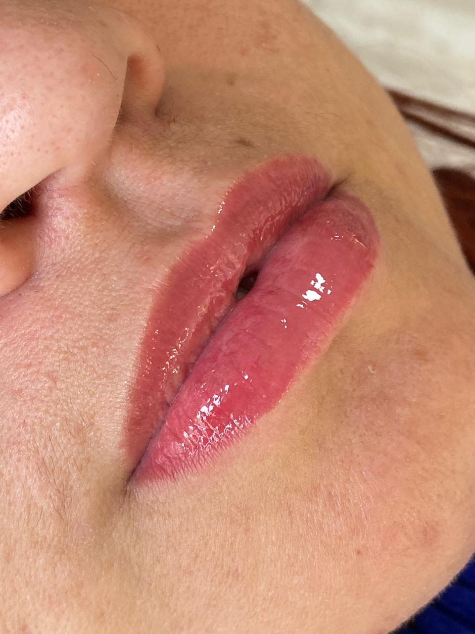 Foto 3 de Micropigmentação Labial