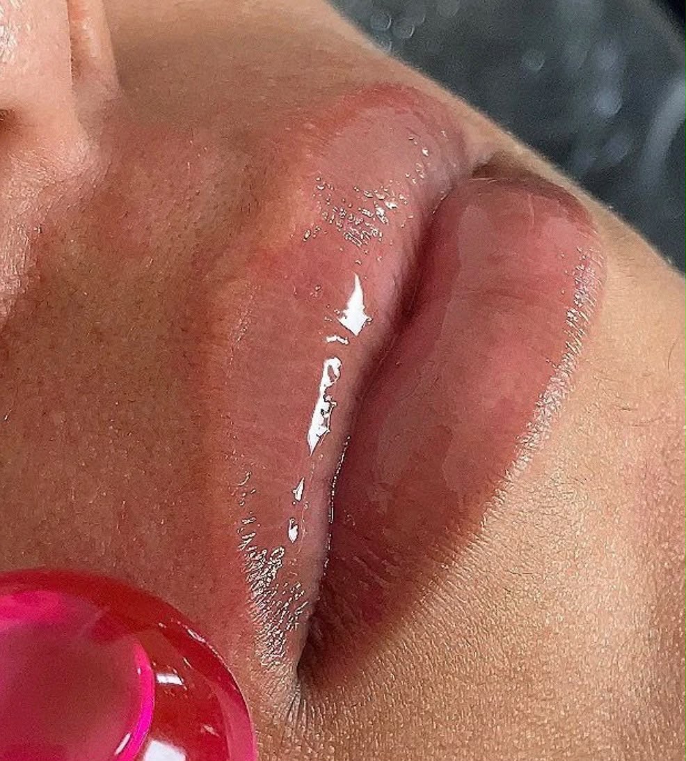 Foto 1 de Depilação Facial